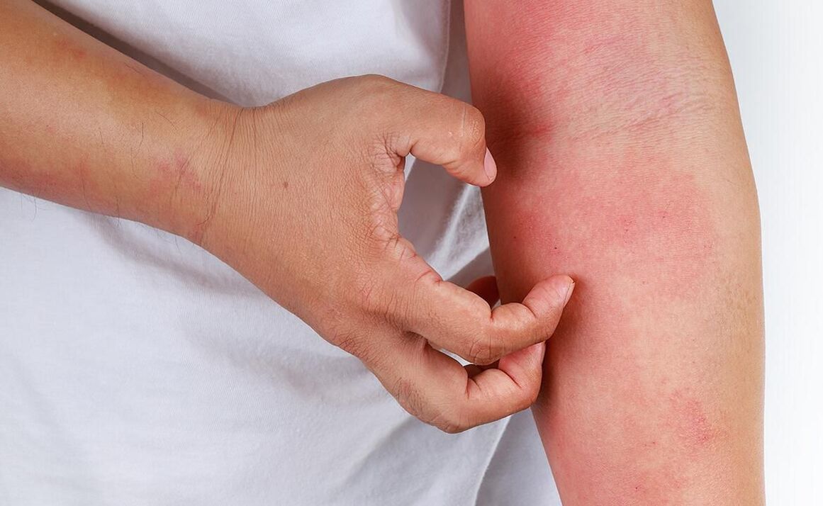 complications possibles liées à l'utilisation de soda